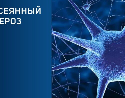 Лечение стволовыми клетками рассеянного склероза  новый прорыв в 2021 году