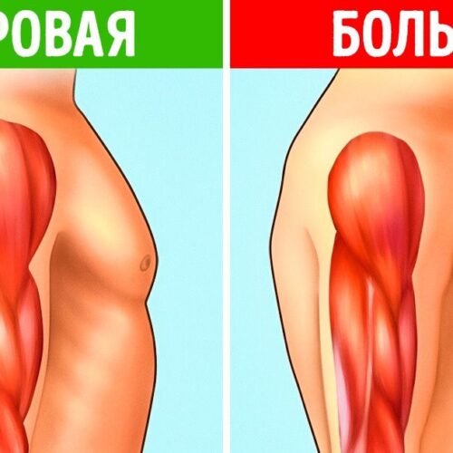 Терапевтическое лечение дистрофии мышц стволовыми клетками