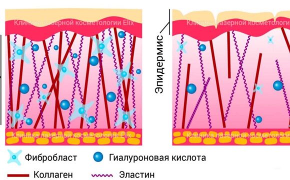 Лучшая процедура восстановления объема лица и молодости кожи после неудачных процедур