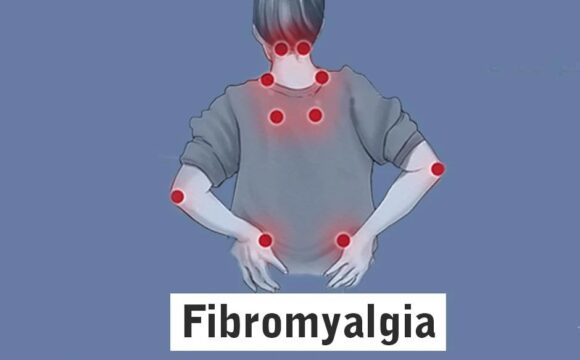 Фибромиалгия — болезнь не мышц, а нервной системы